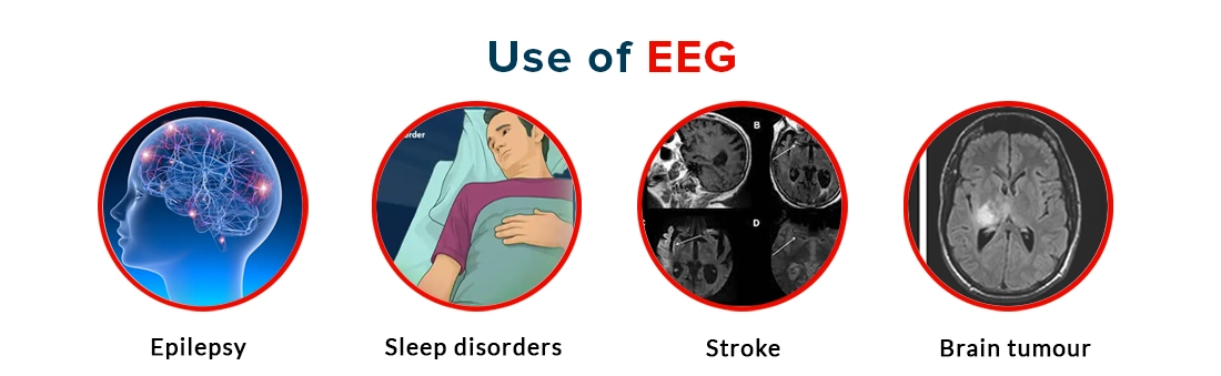Use of EEG